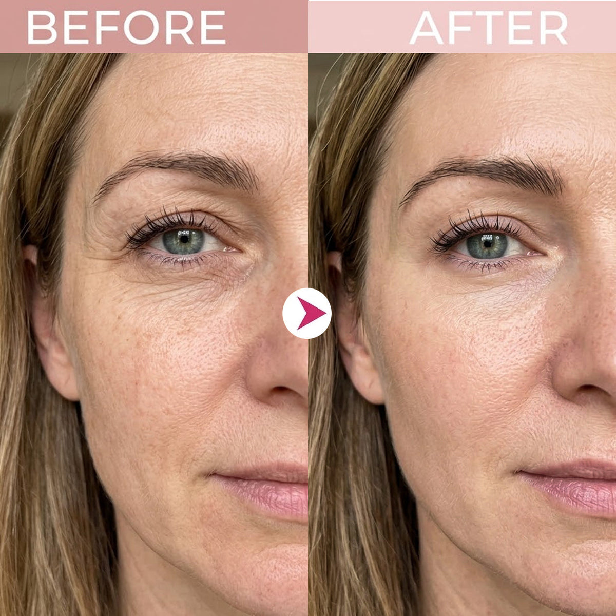 LOVILDS Eye Renewal Crème
